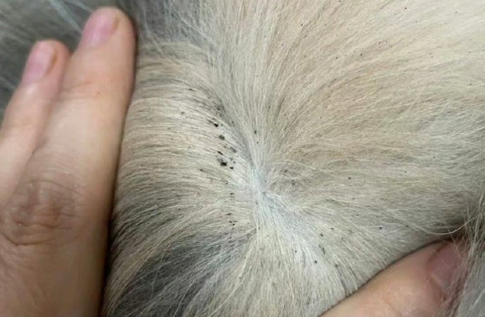 How to treat lice